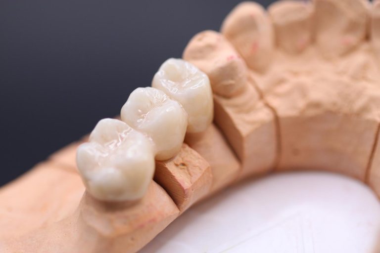 Labdental Puig Prótesis fija