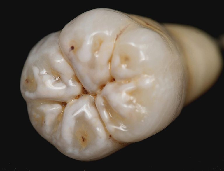 Labdental Puig Prótesis fija