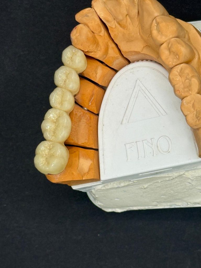Labdental Puig Prótesis fija