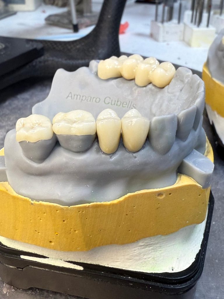 Labdental Puig Prótesis fija