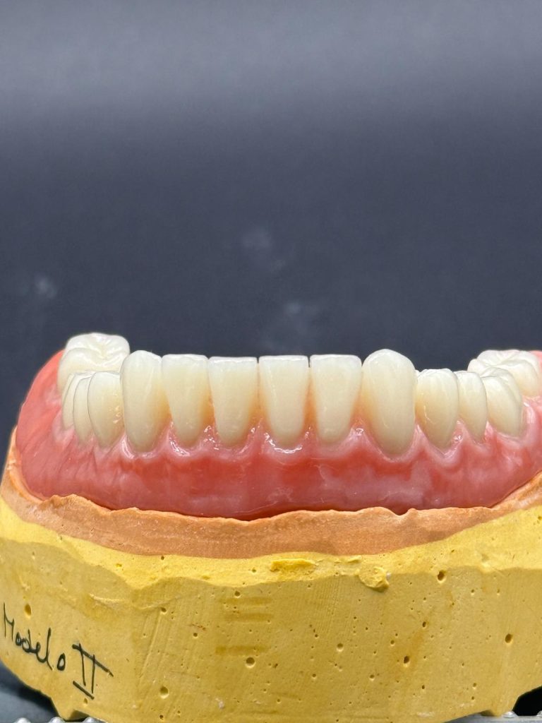 Labdental Puig Prótesis Removibles