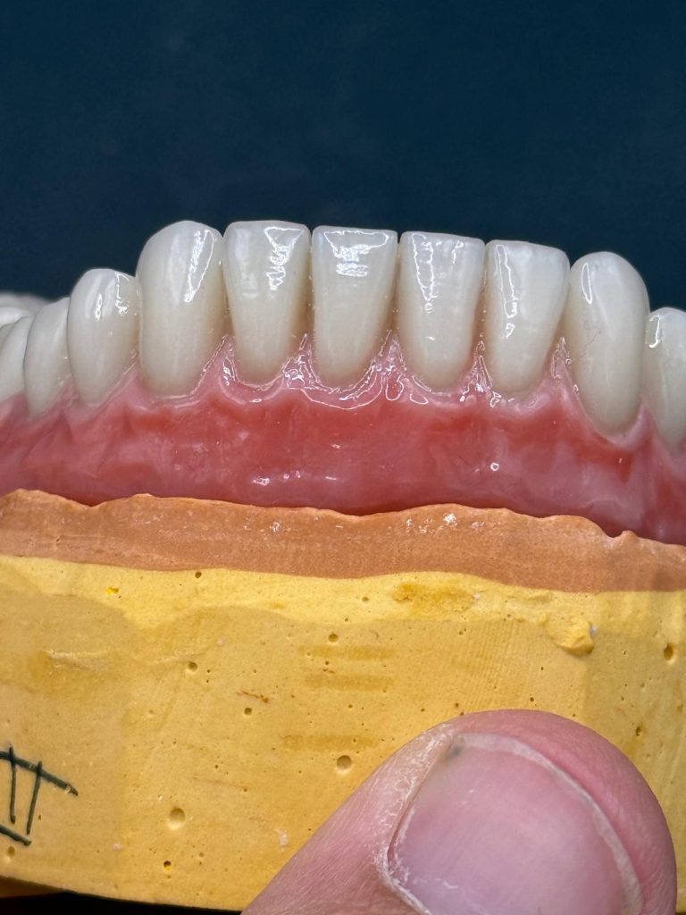 Labdental Puig Prótesis Removibles