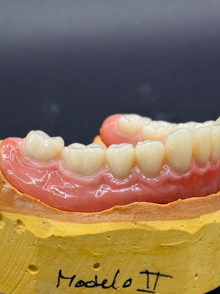 Labdental Puig Prótesis Removibles