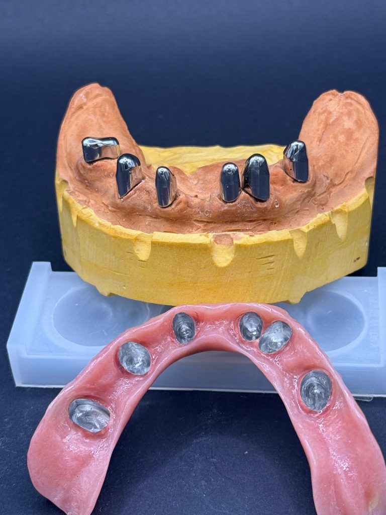 Labdental Puig Prótesis Telescópicas